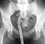 What Did We Get Stuck In Our Rectums Last Year?