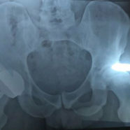 Andy Murray Shares Status Updates On His Hip, Dong